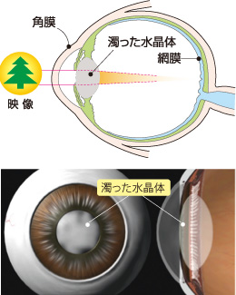 手術前